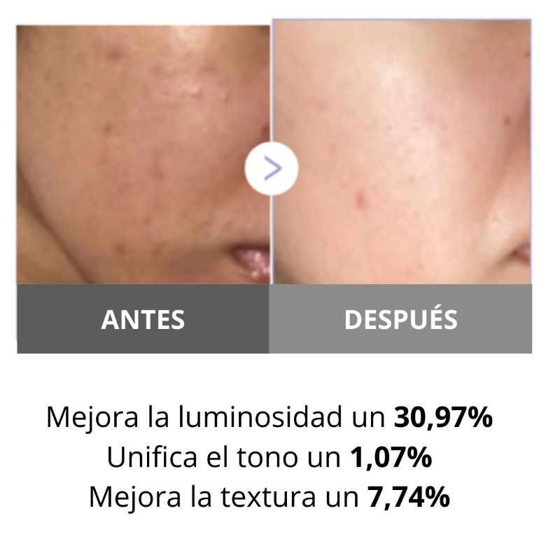 MEDICUBE <br> AGE-R BOOSTER <br> PRO MINI WHITE - Imagen 4